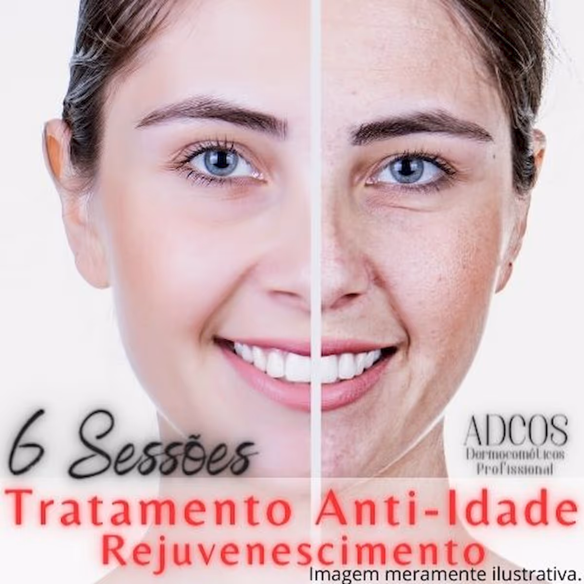 Tratamento ADCOS Pro para Linhas e Rugas no Shopping Nova América - 6 sessões