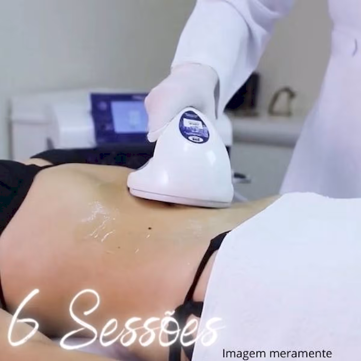 Ultrassom para celulite na ABC Estética Shopping Nova América - Pacote 6 sessões