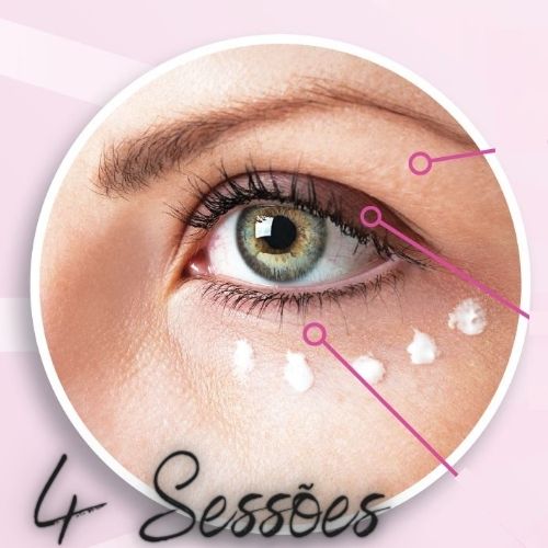 Tratamento Área dos Olhos para Olheiras (Manchas e Bolsas) com